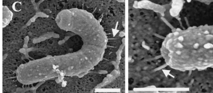 胃の粘膜の表面中のピロリ菌  矢印の部分は針です。針を出して毒素を胃の粘膜に注入しています。